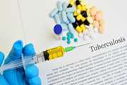 بررسی نتایج IVF بعداز درمان آنتی TB در خانمهای مبتلا به ژنیتال TB مراجعه کننده به درمانگاه نازایی بیمارستان یاس