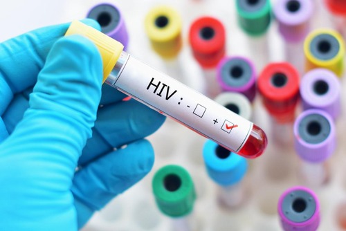 Association between psychological discomforts and sleep quality among people living with HIV/AIDS